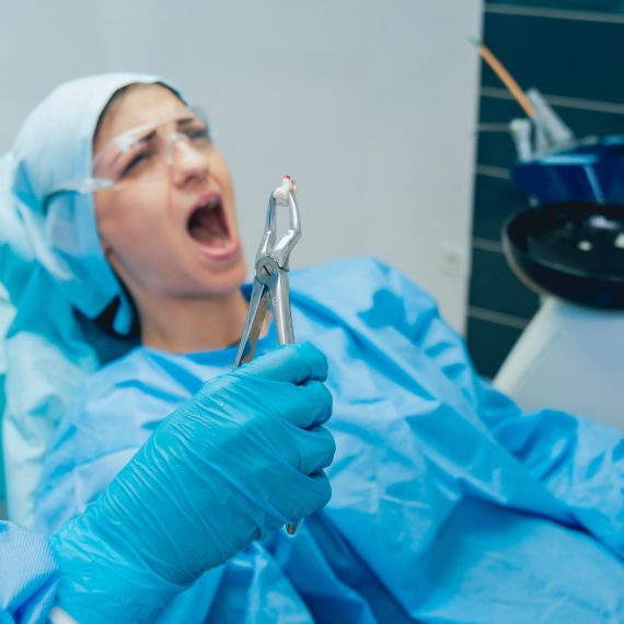 Wisdom Teeth Extraction