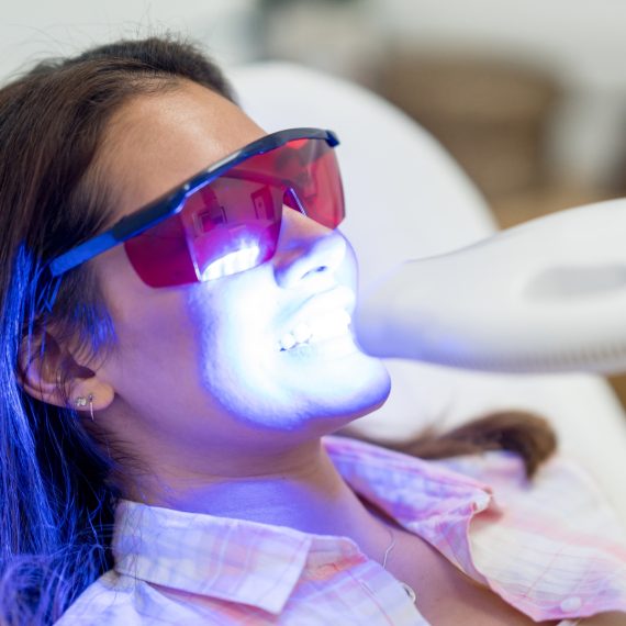 Teeth Whitening